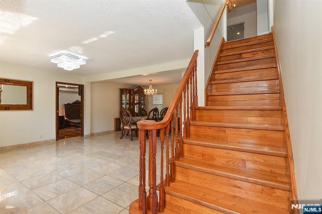 Homes for sale in Dumont, NJ | 156 E Linden Ave, Dumont, NJ 07628 | MLS# 25029229